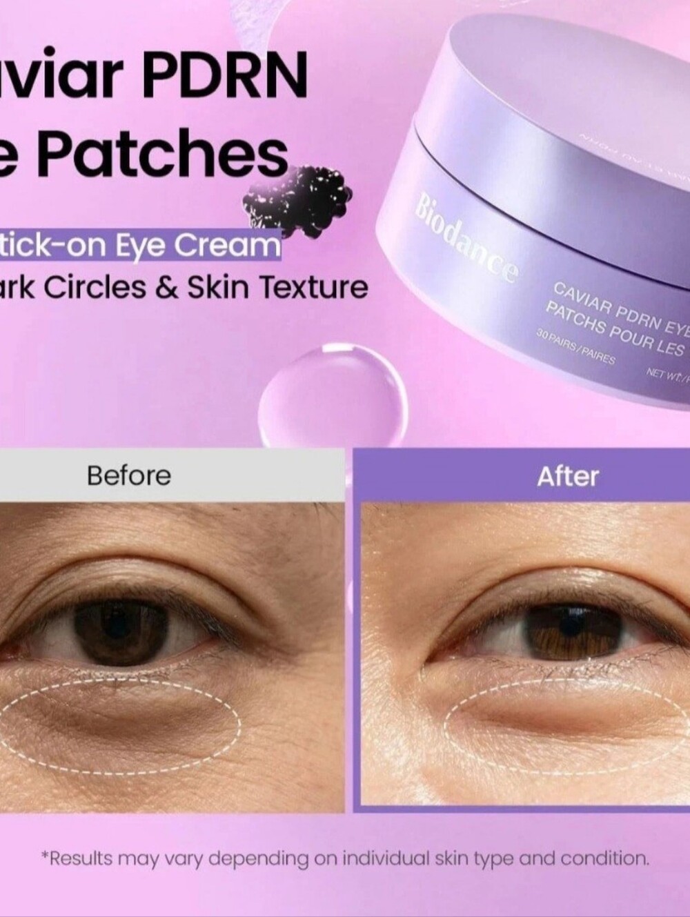 Biodance Caviar PDRN Eye Patches, Nourishing Under Eye Patches for Dark Circles - Picture 2 of 5